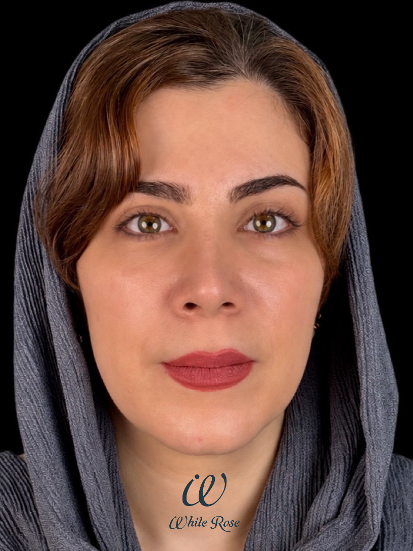 عکس بعد