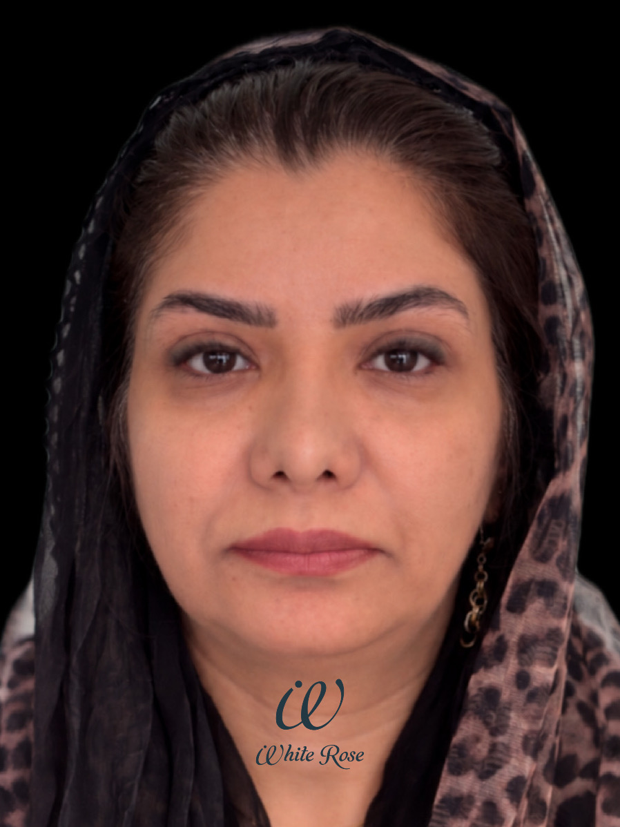 عکس بعد