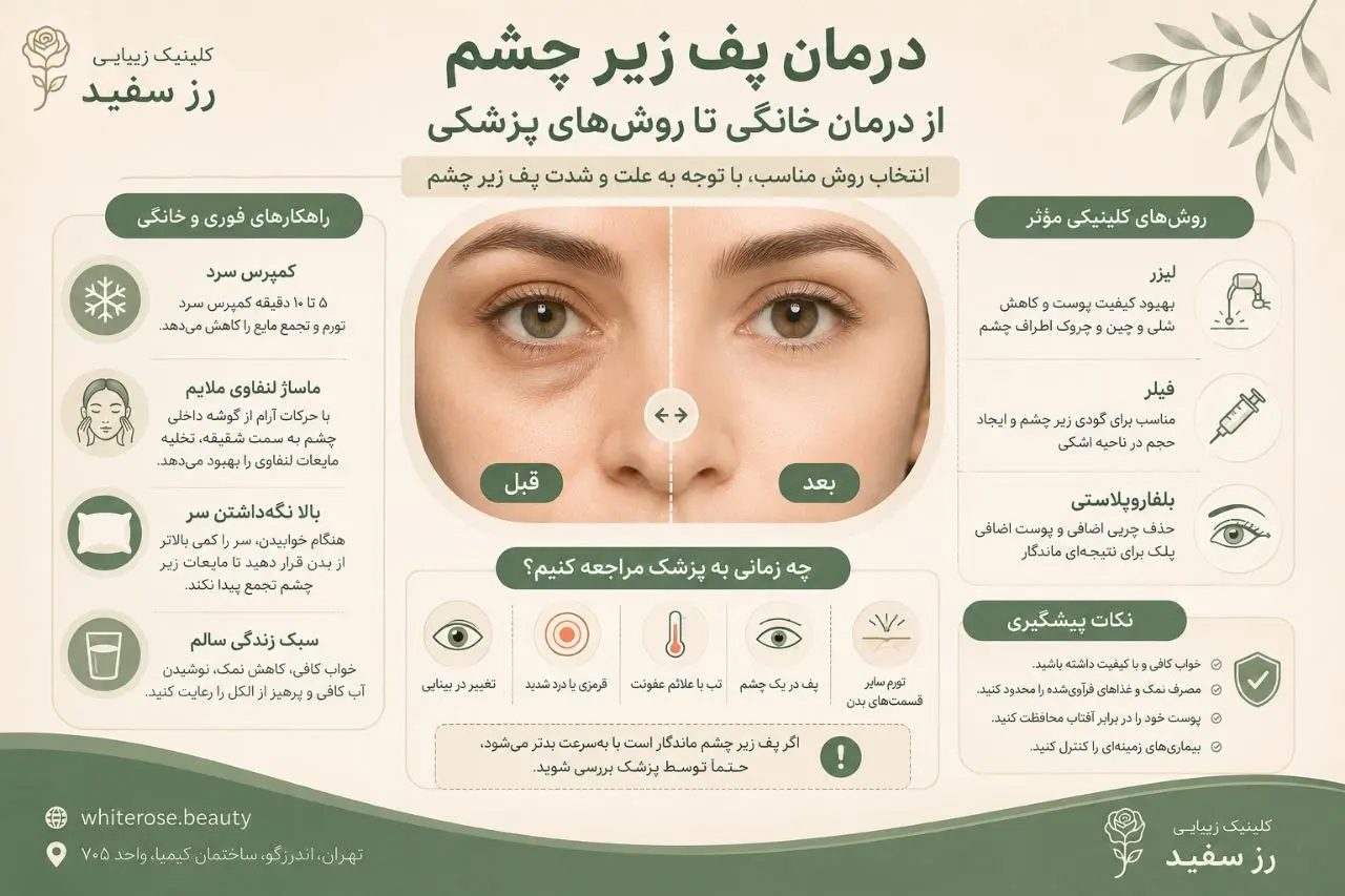 از بین بردن پف زیر چشم