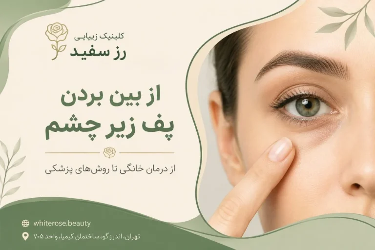از بین بردن پف زیر چشم؛ از درمان خانگی تا روش‌های پزشکی