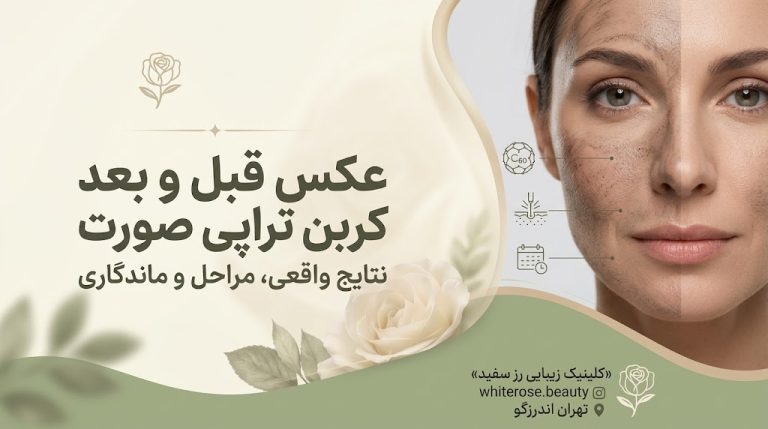عکس قبل و بعد کربن تراپی صورت؛ نتایج واقعی، مراحل و ماندگاری