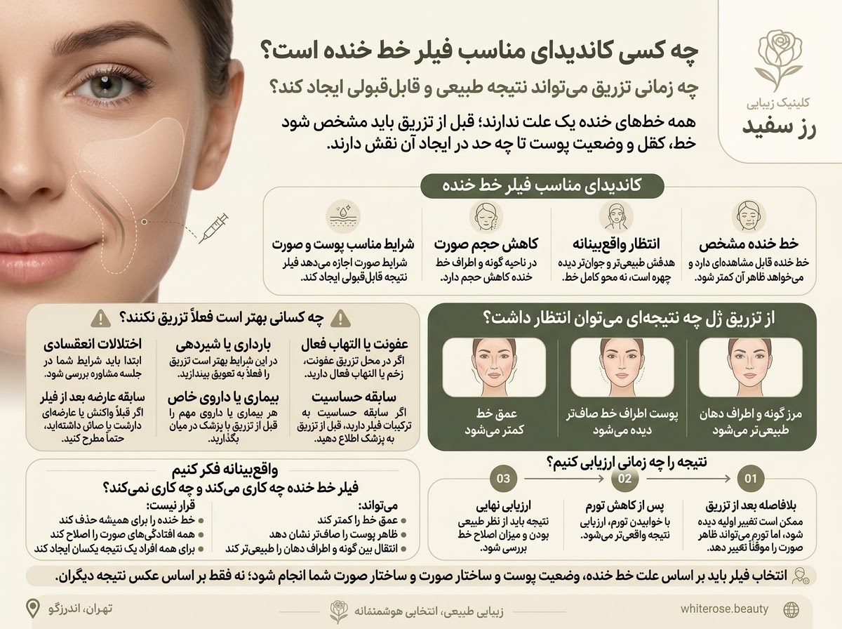 تزریق ژل خط خنده