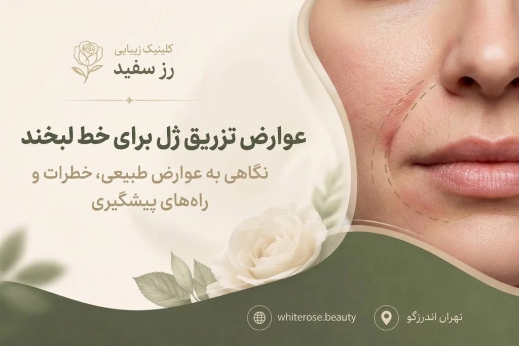 عوارض تزریق ژل برای خط لبخند؛ علائم، پیشگیری و اقدامات فوری