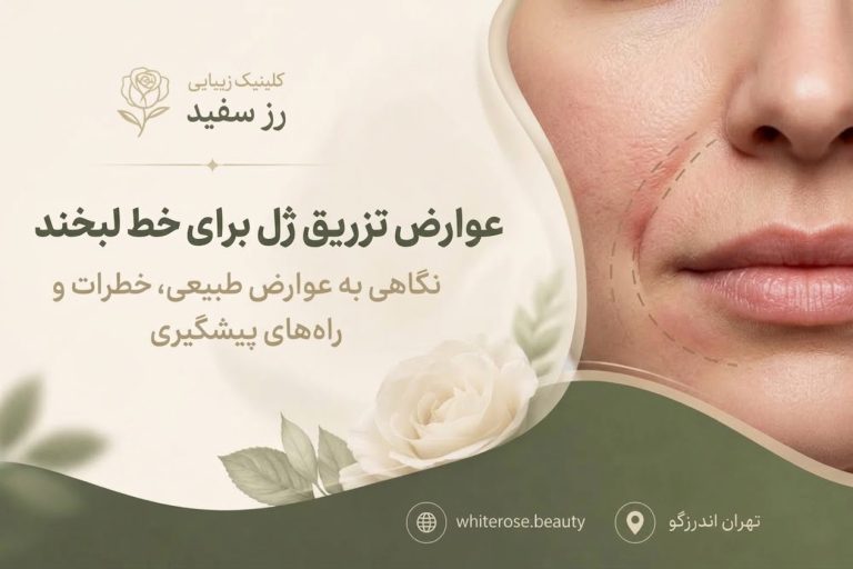 عوارض تزریق ژل برای خط لبخند؛ علائم، پیشگیری و اقدامات فوری