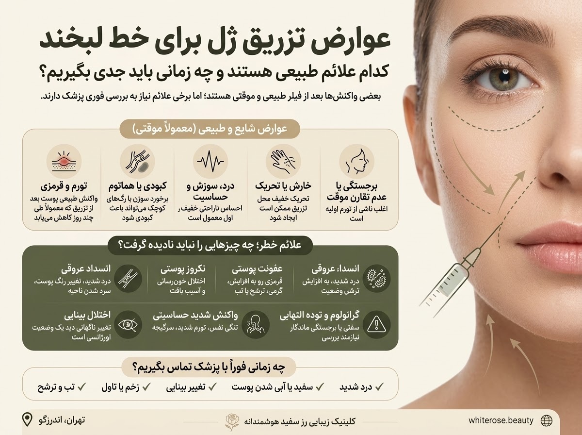 عوارض تزریق ژل برای خط لبخند
