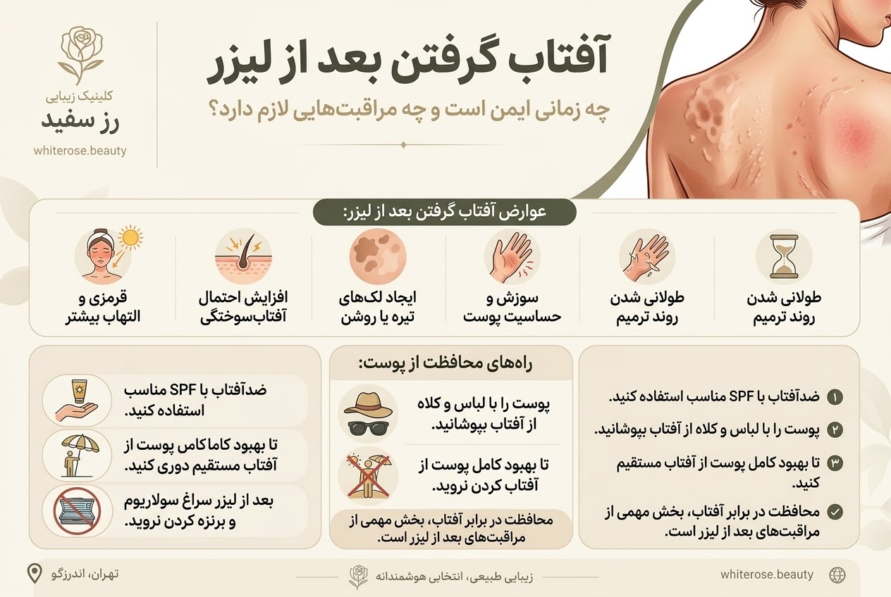 آفتاب گرفتن بعد از لیزر