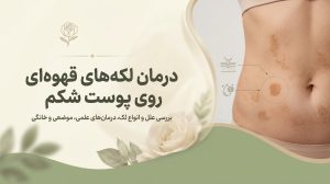 درمان لکه های قهوه ای روی پوست شکم؛ علت و درمان‌های علمی و خانگی