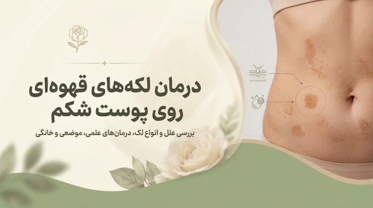 درمان لکه های قهوه ای روی پوست شکم؛ علت و درمان‌های علمی و خانگی