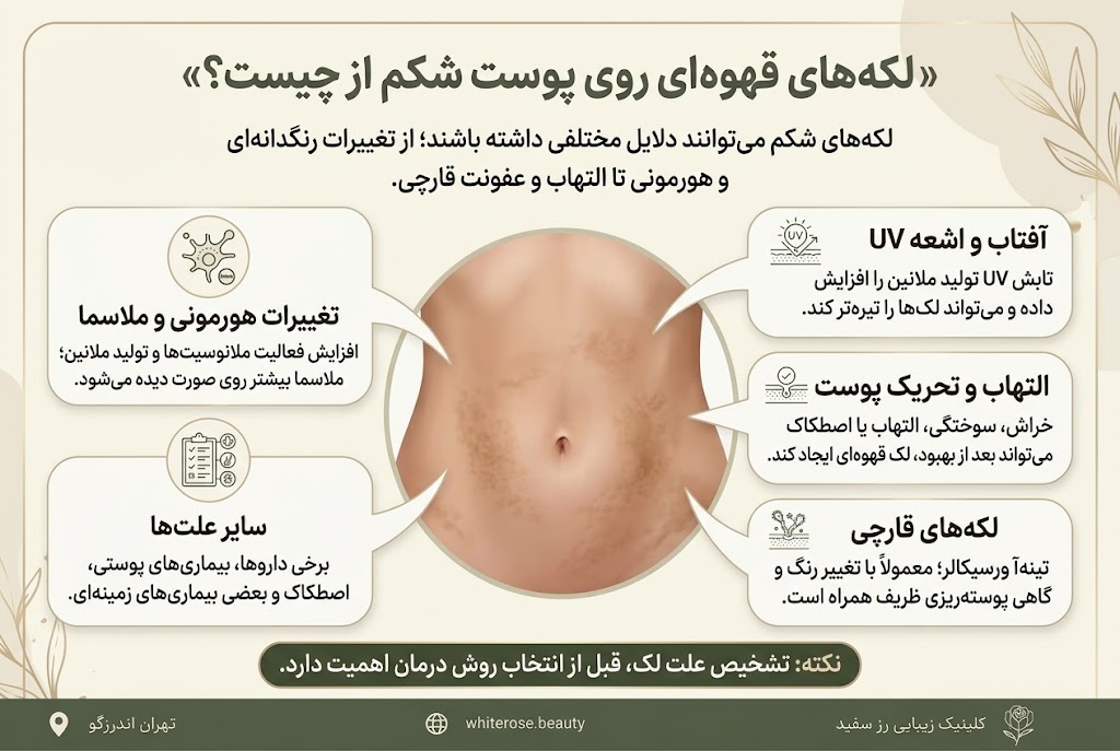 درمان لکه های قهوه ای روی پوست شکم