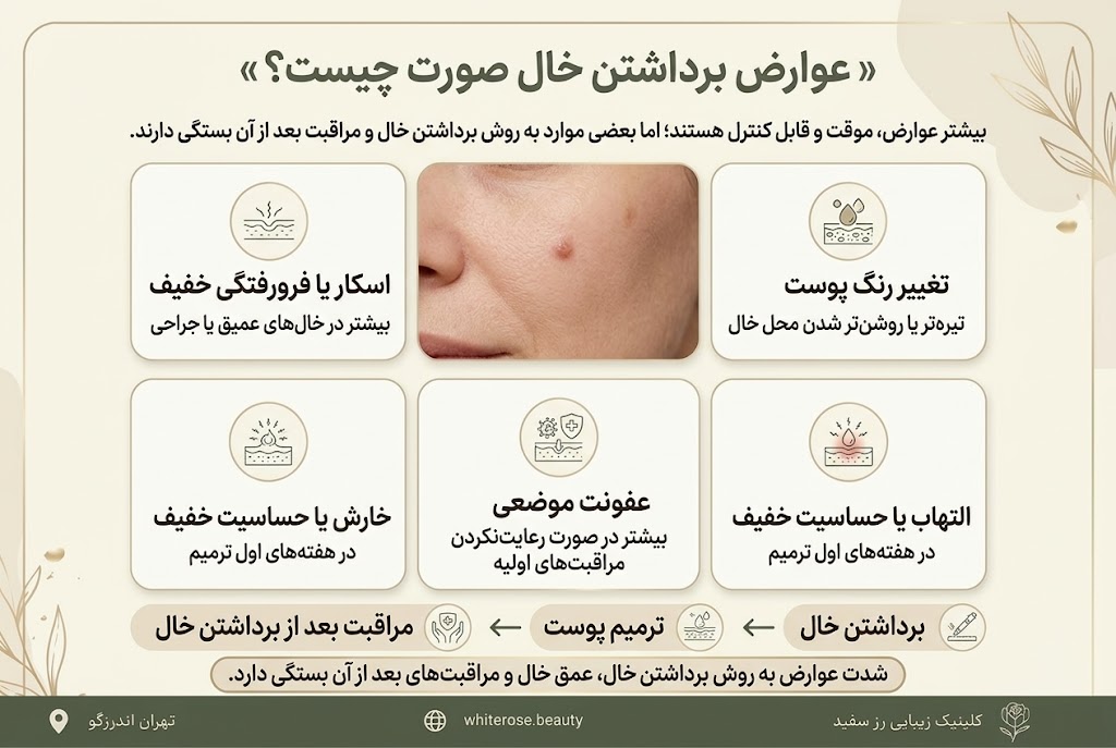 بهترین فصل برای برداشتن خال صورت چه زمانی است؟