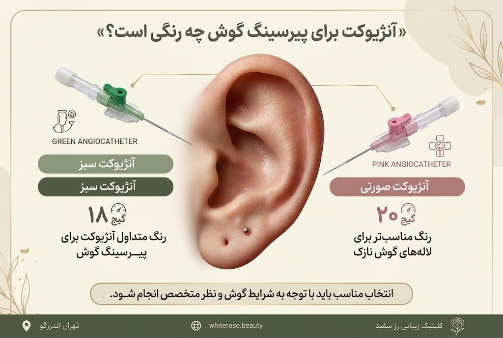 آنژیوکت برای پیرسینگ گوش چه رنگی است؟