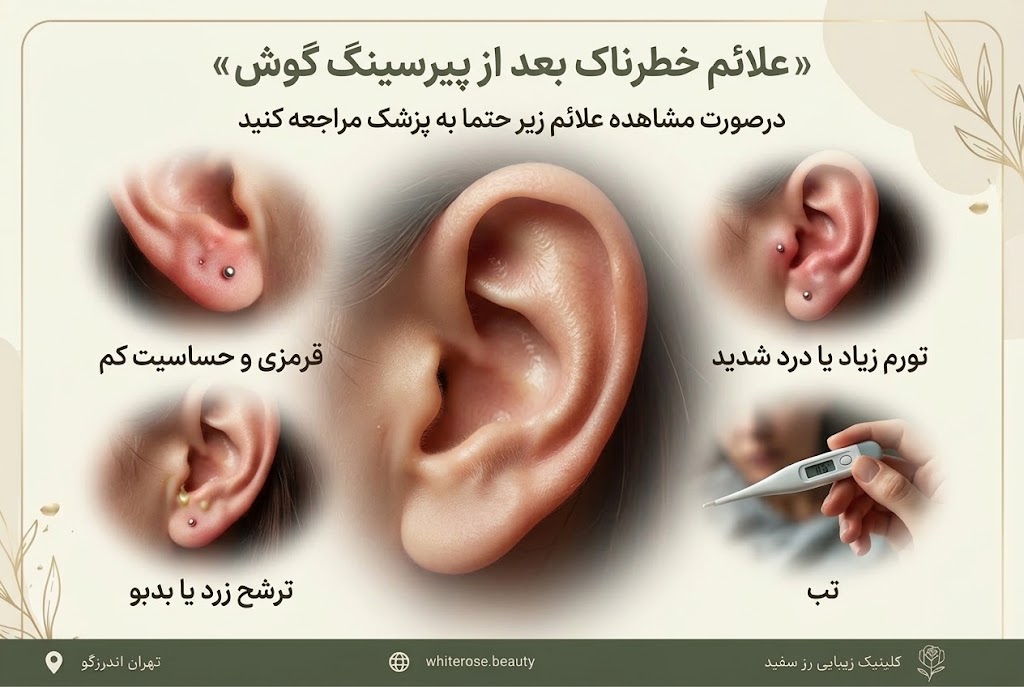 آنژیوکت برای پیرسینگ گوش چه رنگی است؟