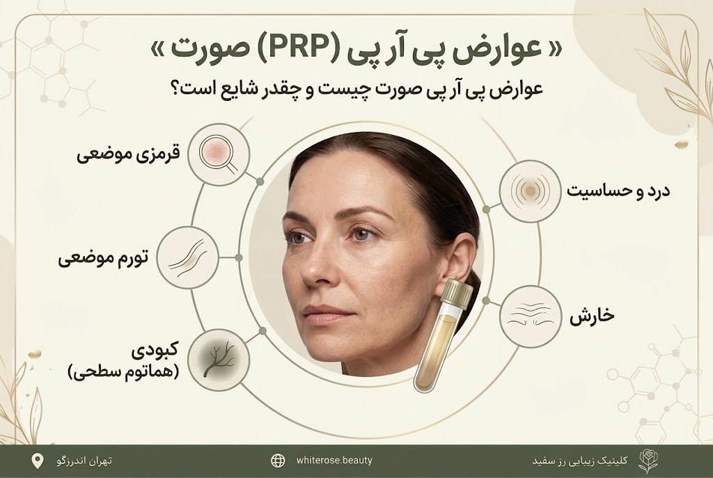 عوارض پی آر پی صورت