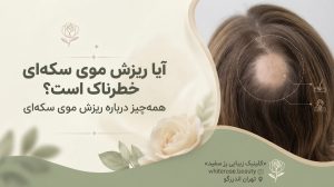 آیا ریزش موی سکه ای خطرناک است؟