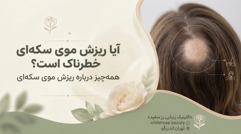 آیا ریزش موی سکه ای خطرناک است؟