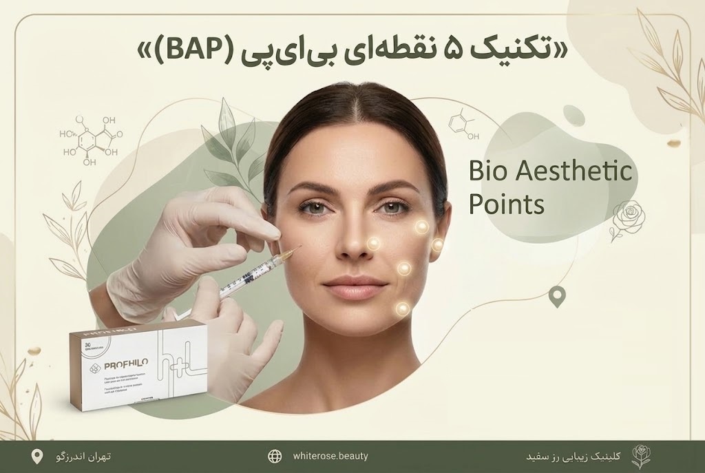 پروفایلو چند سی سی است؟