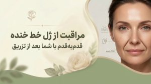 مراقبت از ژل خط خنده؛ قدم‌به‌قدم با شما بعد از تزریق