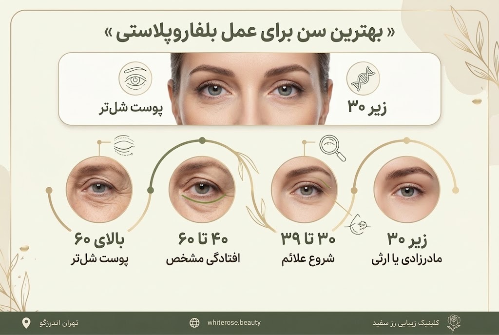 بهترین سن برای عمل بلفاروپلاستی