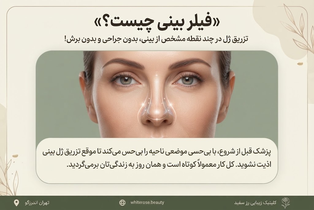 فیلر بینی برای چه کسانی مناسب است؟